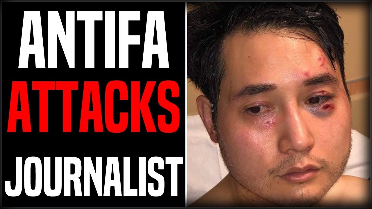 4397 The Truth About the Antifa Attack on Andy Ngo episode artwork